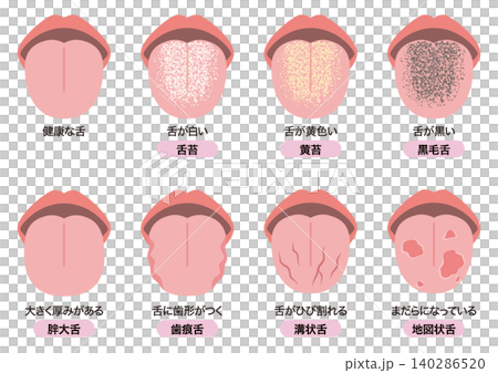 舌でわかる健康状態 140286520