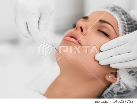 Aesthetic face surgery,cosmetic technique, mesothreads lifting and contouring face Aesthetic face surgery,cosmetic technique, mesothreads lifting and contouring face 140287752