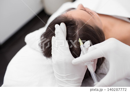 treatment of hair loss, injection for hair growth. Injected in woman's head, hair mesotherapy treatment of hair loss, injection for hair growth. Injected in woman's head, hair mesotherapy 140287772
