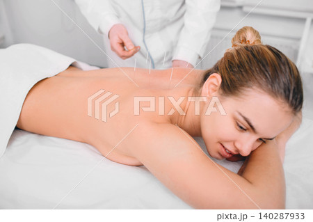 Caucasian woman having traditional chinese acupuncture treatment. Female back with acupuncture needle, Caucasian woman having traditional chinese acupuncture treatment. Female back with acupuncture needle, 140287933