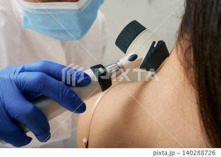 Mole dermatoscopy. Doctor examines the patient's mole with a dermatoscope for prevention of melanoma, close-up. 140288726
