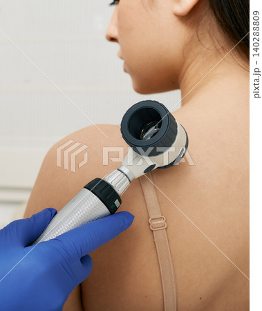 Mole dermoscopy. Physician check-up of a patient's skin with a dermatoscopy for prevention of melanoma and skin cancer, close-up. Mole dermoscopy. Physician check-up of a patient's skin with a dermatoscopy for prevention of melanoma and skin cancer, close-up. 140288809