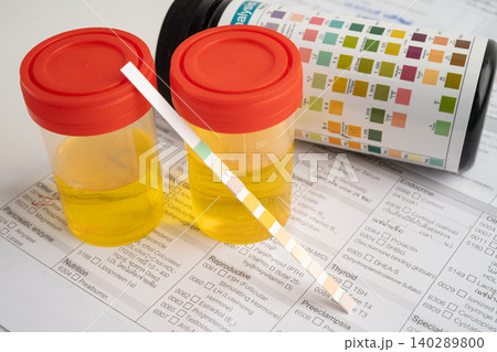 Urinalysis, urine cup with reagent strip pH paper test and comparison chart in laboratory. 140289800
