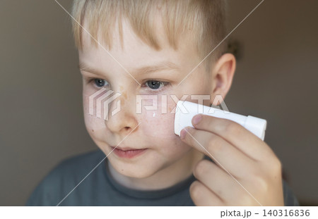 Cute 10 years old boy applying mineral sunscreen stick on his face. Caucasian child protecting freckled skin from sun damage with spf stick at home. 140316836