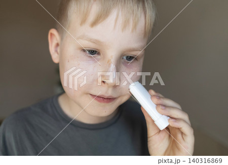 Cute 10 years old boy applying mineral sunscreen stick on his face. Caucasian child protecting freckled skin from sun damage with spf stick at home. Cute 10 years old boy applying mineral sunscreen stick on his face. Caucasian child protecting freckled skin from sun damage with spf stick at home. 140316869