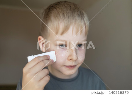 Cute 10 years old boy applying mineral sunscreen stick on his face. Caucasian child protecting freckled skin from sun damage with spf stick at home. Cute 10 years old boy applying mineral sunscreen stick on his face. Caucasian child protecting freckled skin from sun damage with spf stick at home. 140316879