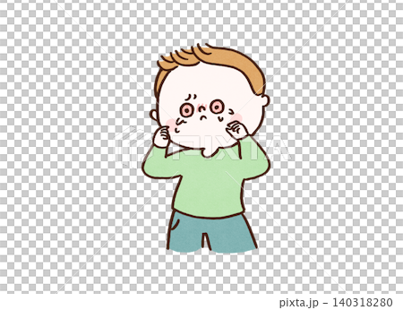 A man's eyes became bright red and bloodshot due to itching (hay fever/allergy). A man's eyes became bright red and bloodshot due to itching (hay fever/allergy). 140318280