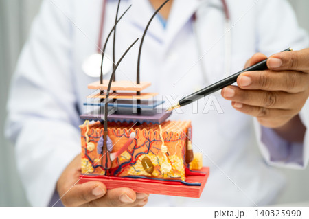 Hair transplant, Asian dermatologist doctor holding skin structure anatomy model for treatment in hospital. Hair transplant, Asian dermatologist doctor holding skin structure anatomy model for treatment in hospital. 140325990
