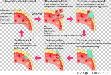 Schematic diagram of the process from vascular injury to hemostasis, blood coagulation, and vascular repair (in German) 140339592
