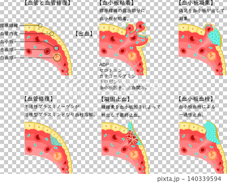血管損傷至止血、血液凝固及血管修復過程示意圖(日文圖) 血管損傷至止血、血液凝固及血管修復過程示意圖(日文圖) 140339594