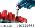Ebola Virus Blood Test Sample 140339663