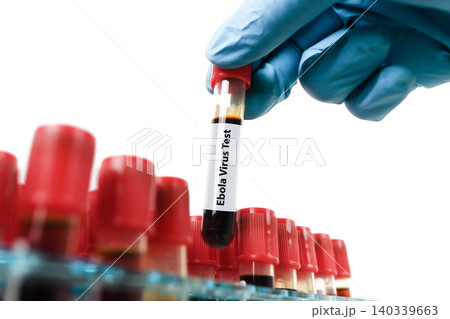 Ebola Virus Blood Test Sample 140339663
