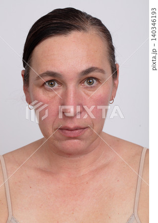 Middle-aged woman in profile with age-related changes requiring plastic surgery. 140346193