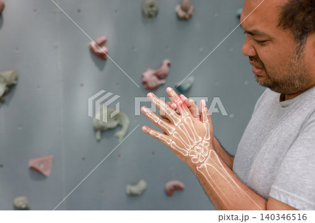 Overweight Asian man suffering from index finger joint pain with glowing bone anatomy graphic overlay after rock climbing exercise. Sports injury and medical healthcare concept. Overweight Asian man suffering from index finger joint pain with glowing bone anatomy graphic overlay after rock climbing exercise. Sports injury and medical healthcare concept. 140346516