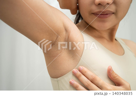 Asian woman have problem black armpit beauty skin care. 140348035