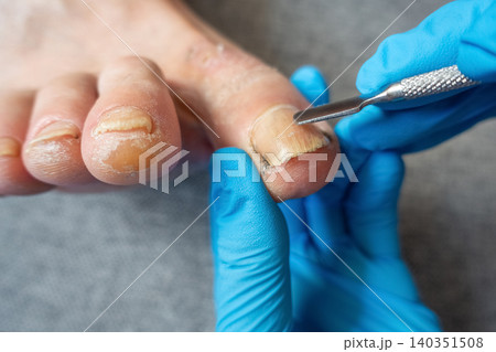 Cuticle Removal During Professional Pedicure Treatment Cuticle Removal During Professional Pedicure Treatment 140351508