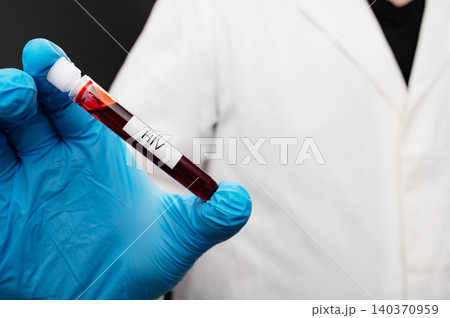 Gloved Hand Holding HIV Positive Blood Test Tube Gloved Hand Holding HIV Positive Blood Test Tube 140370959