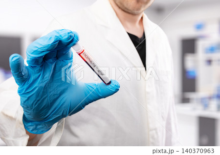 Scientist Holding Tick-borne Encephalitis Blood Sample Tube 140370963