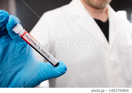 Scientist Holding Tick-borne Encephalitis Blood Sample Tube 140370964