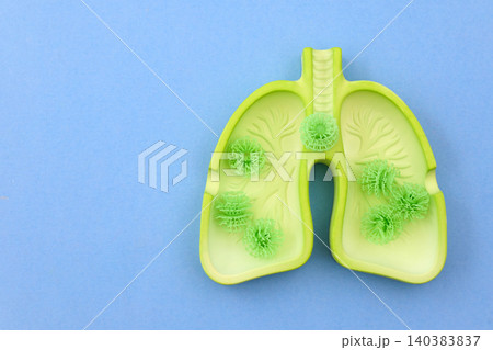 Lungs model showing virus infection and disease Lungs model showing virus infection and disease 140383837