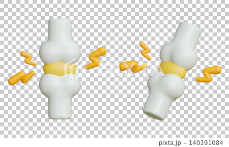 3D Rendered Bone Joint with Pain and Inflammation Effects for Arthritis Concept Design 3D Rendered Bone Joint with Pain and Inflammation Effects for Arthritis Concept Design 140391084
