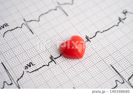 Electrocardiogram ECG, heart wave, heart attack, cardiogram report. 140398680