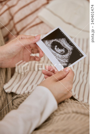 エコー写真を手に持つ妊婦 140401474