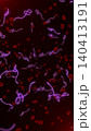 Microscopic view of infectious Ebola Virus cells (virions) and red blood cells flowing through the human bloodstream.  140413191