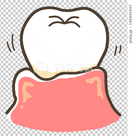 歯周病で歯がグラグラしているイラスト 歯周病で歯がグラグラしているイラスト 140445447