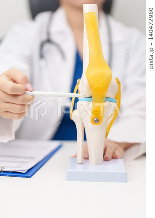 Doctor with Human Knee joint anatomy model. Osteoarthritis, Patellofemoral Pain Syndrome, Patellar Tendinitis, ACL, Anterior Cruciate Ligament, PCL, Posterior, MCL, Medial Collateral, LCL and Lateral Doctor with Human Knee joint anatomy model. Osteoarthritis, Patellofemoral Pain Syndrome, Patellar Tendinitis, ACL, Anterior Cruciate Ligament, PCL, Posterior, MCL, Medial Collateral, LCL and Lateral 140472980