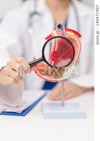 Doctor with Gastric anatomy model. Gastroenterologist consultation, stomach diseases and ulcers, November stomach cancer, Gastroesophageal Reflux Disease, GERD, Acid reflux and healthcare medical 140472987