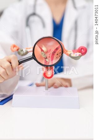 Doctor with Uterus and Ovaries anatomy model. Ovarian and Cervical cancer, Cervix disorder, Endometriosis, Hysterectomy, Uterine fibroids, Reproductive system, Pregnancy and health concept Doctor with Uterus and Ovaries anatomy model. Ovarian and Cervical cancer, Cervix disorder, Endometriosis, Hysterectomy, Uterine fibroids, Reproductive system, Pregnancy and health concept 140473011