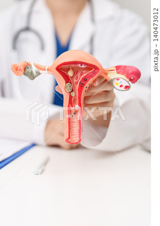 Doctor with Uterus and Ovaries anatomy model. Ovarian and Cervical cancer, Cervix disorder, Endometriosis, Hysterectomy, Uterine fibroids, Reproductive system, Pregnancy and health concept Doctor with Uterus and Ovaries anatomy model. Ovarian and Cervical cancer, Cervix disorder, Endometriosis, Hysterectomy, Uterine fibroids, Reproductive system, Pregnancy and health concept 140473012