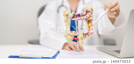 Doctor with human Colon anatomy model. Colonic disease, Large Intestine, Colorectal cancer, Ulcerative colitis, Diverticulitis, Irritable bowel syndrome, Digestive system and Healthcare concept Doctor with human Colon anatomy model. Colonic disease, Large Intestine, Colorectal cancer, Ulcerative colitis, Diverticulitis, Irritable bowel syndrome, Digestive system and Healthcare concept 140473033