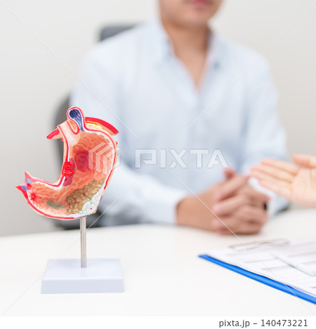 Doctor with Gastric anatomy model. Gastroenterologist consultation, stomach diseases and ulcers, November stomach cancer, Gastroesophageal Reflux Disease, GERD, Acid reflux and healthcare medical Doctor with Gastric anatomy model. Gastroenterologist consultation, stomach diseases and ulcers, November stomach cancer, Gastroesophageal Reflux Disease, GERD, Acid reflux and healthcare medical 140473221