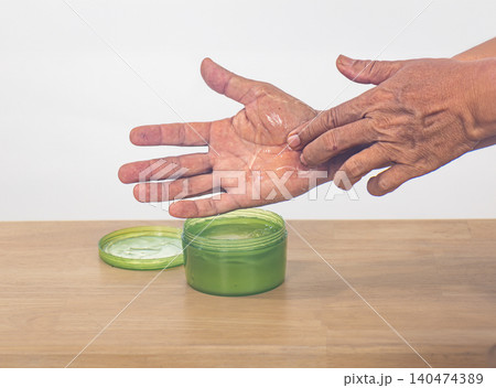 Senior man apply aloe vera gel on skin peeling hand. Senior man apply aloe vera gel on skin peeling hand. 140474389