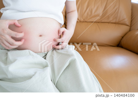 Pregnant woman scratched her belly because of itchy skin while sitting on a sofa at home. Belly itching during pregnancy can be caused by skin stretching, dry skin, or other health conditions. Pregnant woman scratched her belly because of itchy skin while sitting on a sofa at home. Belly itching during pregnancy can be caused by skin stretching, dry skin, or other health conditions. 140484100