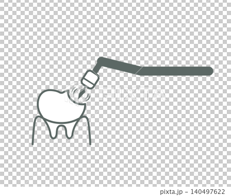 An illustration of a tooth being drilled during cavity treatment. An illustration of a tooth being drilled during cavity treatment. 140497622