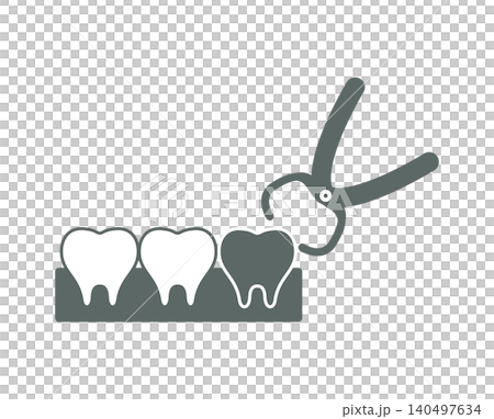 An illustration depicting the extraction of a single tooth, such as one that has become problematic due to decay, using forceps. An illustration depicting the extraction of a single tooth, such as one that has become problematic due to decay, using forceps. 140497634