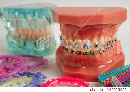 Orthodontic ligatures rings and ties, elastic rubber bands on orthodontic braces, model for dentist studying about dentistry. Orthodontic ligatures rings and ties, elastic rubber bands on orthodontic braces, model for dentist studying about dentistry. 140513935