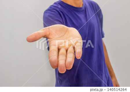 Man showing palm with callus. Skin irritation on hand due to heavy physical labor. Dermatology and health care concept. Medical observation of blister and wound on adult worker hand. Man showing palm with callus. Skin irritation on hand due to heavy physical labor. Dermatology and health care concept. Medical observation of blister and wound on adult worker hand. 140514264