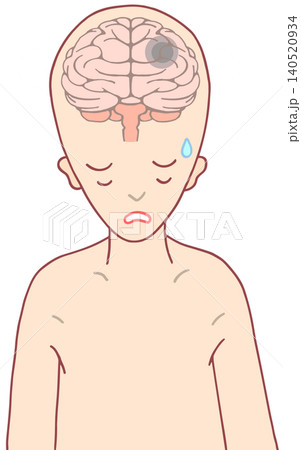 脳の疾患 - 脳腫瘍・頭蓋内新生物・脳疾患 脳の疾患 - 脳腫瘍・頭蓋内新生物・脳疾患 140520934