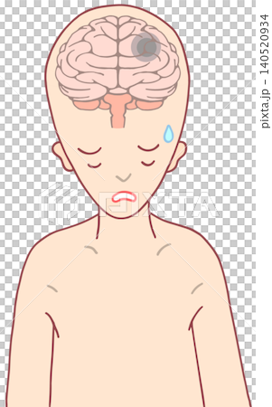 脳の疾患 - 脳腫瘍・頭蓋内新生物・脳疾患 脳の疾患 - 脳腫瘍・頭蓋内新生物・脳疾患 140520934