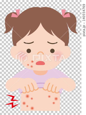 患有膿皰瘡的女孩 患有膿皰瘡的女孩 140554769