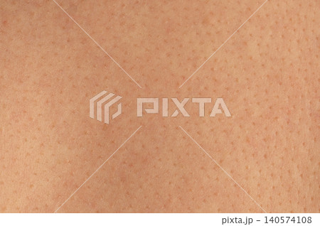 Many pores on brown human skin background Many pores on brown human skin background 140574108