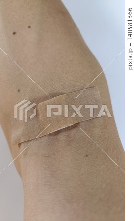 採決した腕 採決した腕 140581366