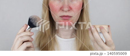 Blonde woman applying face powder to conceal skin redness, rosacea symptoms, or sunburn. Girl covering up damaged, irritated skin with cosmetic makeup brush. Blonde woman applying face powder to conceal skin redness, rosacea symptoms, or sunburn. Girl covering up damaged, irritated skin with cosmetic makeup brush. 140595009