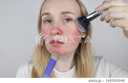Blonde woman applying face powder to conceal skin redness, rosacea symptoms, or sunburn. Girl covering up damaged, irritated skin with cosmetic makeup brush. Blonde woman applying face powder to conceal skin redness, rosacea symptoms, or sunburn. Girl covering up damaged, irritated skin with cosmetic makeup brush. 140595046