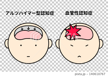 Simple hand-drawn illustration of dementia Simple hand-drawn illustration of dementia 140618767