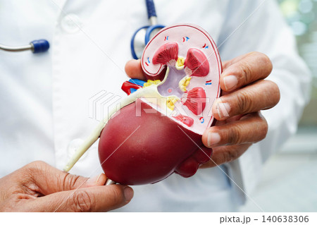 Chronic kidney disease, doctor with model for treatment urinary system, urology, Estimated glomerular filtration rate eGFR. 140638306